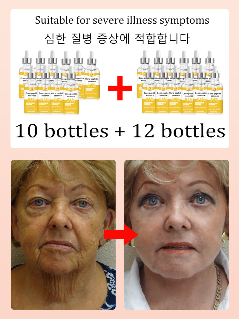 NO Wrinkle, 20 years younger