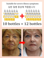 NO Wrinkle, 20 years younger