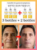 NO Wrinkle, 20 years younger