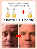NO Wrinkle, 20 years younger