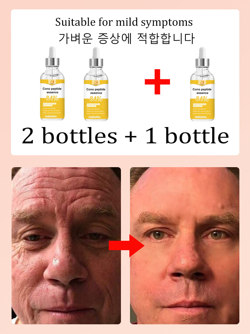 NO Wrinkle, 20 years younger
