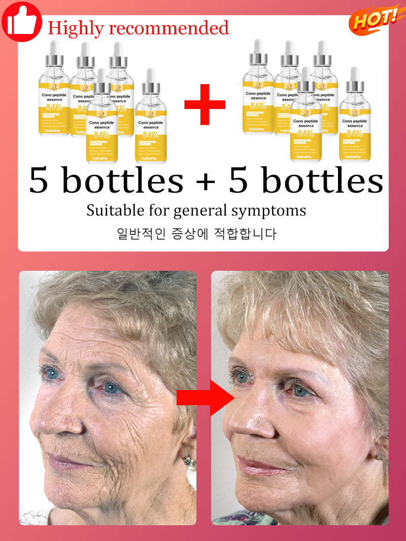 NO Wrinkle, 20 years younger